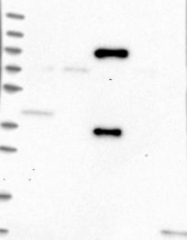 NBP1-86908 - Treacle protein / TCOF1