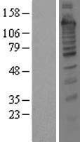 NBL1-16785 - Treacher Collins syndrome protein Lysate