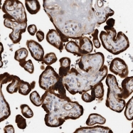 NBP1-80687 - Trichohyalin