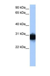 NBP1-52881 - Triosephosphate isomerase (TPI1)