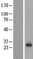 NBL1-17217 - Triosephosphate isomerase Lysate