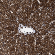 NBP1-86022 - Tripeptidyl-peptidase 2 (TPP2)