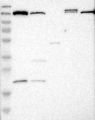 NBP1-86022 - Tripeptidyl-peptidase 2 (TPP2)