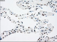 NBP1-47898 - TrkB