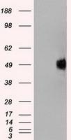 NBP1-47898 - TrkB