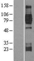 NBL1-13836 - TrkB Lysate