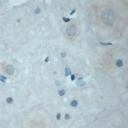 NB100-98829 - TrkC