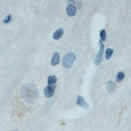 NB100-98829 - TrkC