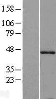 NBL1-17115 - Tropomodulin-1 (TMOD1) Lysate