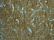 NBP1-95925 - Tropomodulin-2 (TMOD2)