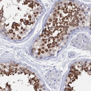 NBP1-87378 - Tropomodulin-2 (TMOD2)