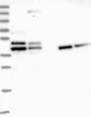 NBP1-87378 - Tropomodulin-2 (TMOD2)