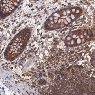 NBP1-86870 - Tropomodulin-3 (TMOD3)