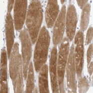 NBP1-80745 - Tropomodulin-4 (TMOD4)