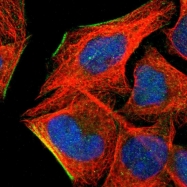 NBP1-89896 - Tropomyosin-1 (TPM1)