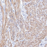 NBP1-89896 - Tropomyosin-1 (TPM1)