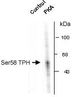 NB300-260 - Tryptophan 5-hydroxylase 1 (TPH1)