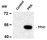 NB300-260 - Tryptophan 5-hydroxylase 1 (TPH1)
