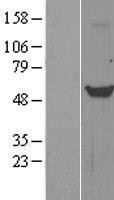 NBL1-17216 - Tryptophan Hydroxylase 1 Lysate