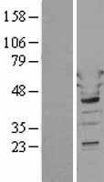 NBL1-17772 - Tryptophanyl tRNA synthetase Lysate
