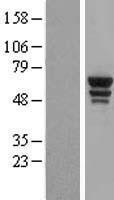 NBL1-17773 - Tryptophanyl tRNA synthetase Lysate