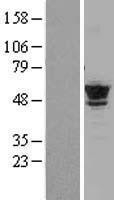 NBL1-17439 - Tubulin Beta 2C Lysate