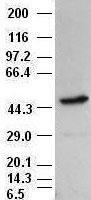 NBP1-48038 - TUBB3 / TUBB4