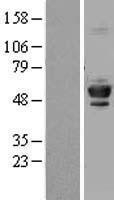 NBL1-17441 - Tubulin Beta 4 Lysate