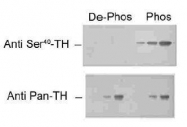 NB300-173 - Tyrosine 3-monooxygenase (TH)