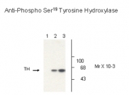 NB300-212 - Tyrosine 3-monooxygenase (TH)