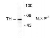 NB300-110 - Tyrosine 3-monooxygenase (TH)