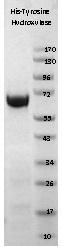 NBP1-42461 - Tyrosine 3-monooxygenase (TH)
