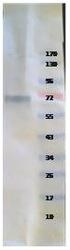 NBP1-42461 - Tyrosine 3-monooxygenase (TH)
