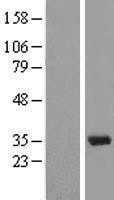 NBL1-16285 - U1A Lysate