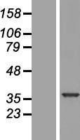 NBL1-17488 - U1SNRNPBP Lysate