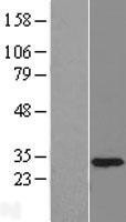 NBL1-17489 - U1SNRNPBP Lysate