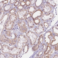 NBP1-92554 - UACA