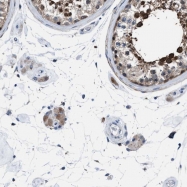 NBP1-89197 - UAP1 / AGX