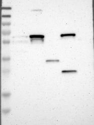 NBP1-89197 - UAP1 / AGX