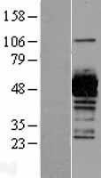NBL1-17493 - UAP1 Lysate