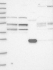 NBP1-83150 - UBA3 / UBE1C