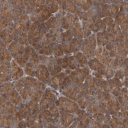 NBP1-80651 - UBAP1 / NAG20