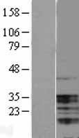 NBL1-17504 - UBAP1 Lysate