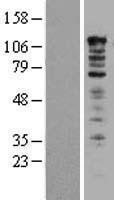 NBL1-17505 - UBAP2L Lysate