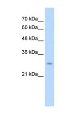 NBP1-59760 - UBE2J2