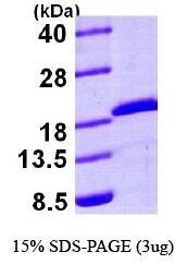 NBP1-44378 - UBE2A / RAD6A