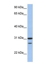 NBP1-58165 - UBE2C / UBCH10
