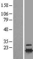 NBL1-17514 - UBE2C Lysate