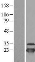 NBL1-17516 - UBE2C Lysate