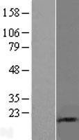 NBL1-17518 - UBE2D1 Lysate